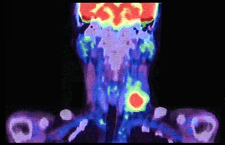Illustration for article titled The Healing Power Of Antimatter